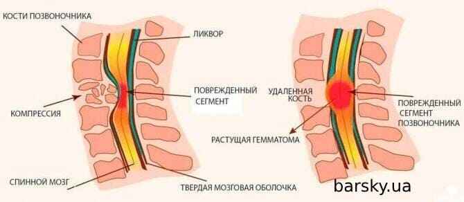 если болит голова в компьютерном кресле