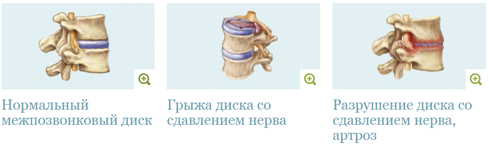 сидячая работа осложнения на работе