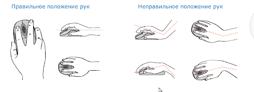 симптоматика туннельного синдрома