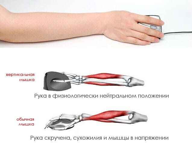 симптомы и болезнь туннельного синдрома риск